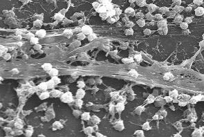 Nanopartícules Per A Combatre Les Infeccions Cròniques