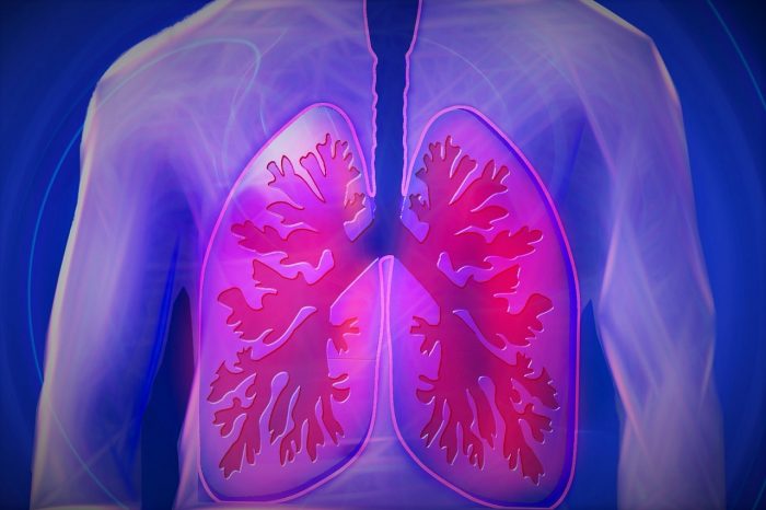 Un Gen Supresor De Cáncer Juega Un Papel Clave En Las Infecciones Pulmonares De La Fibrosis Quística